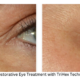 Restorative Eye Treatment with TriHex Technology